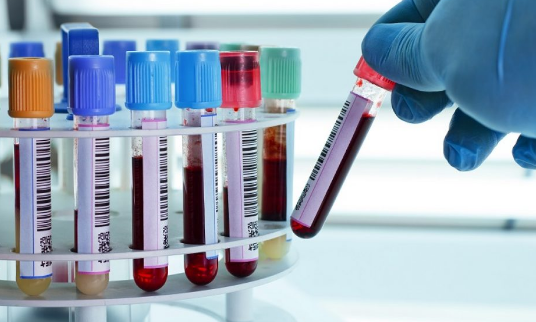 मुंबईकरांसाठी मोफत रक्त तपासणी, बीएमसीची घोषणा